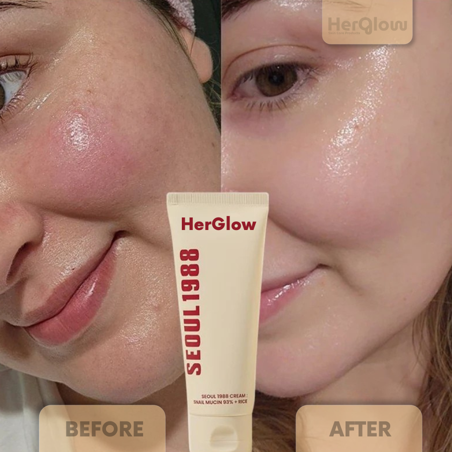 HerGlow™ - Cream : Snail Mucin 97% + Rice