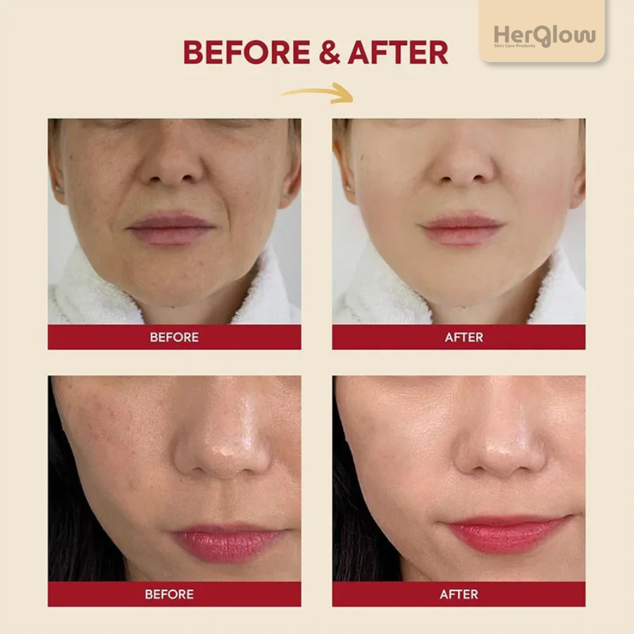 HerGlow™ - Toner : Skin Mucin 97% + Rice